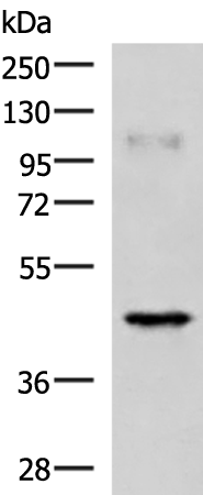Rabbit Polyclonal Antibody to RAB3IL1