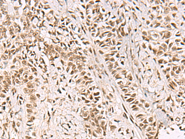 Rabbit Polyclonal Antibody to GABPB1