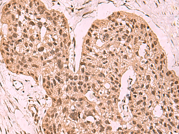Rabbit Polyclonal Antibody to SETDB1