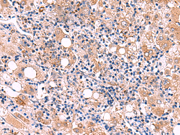 Rabbit Polyclonal Antibody to LIPA