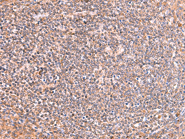 Rabbit Polyclonal Antibody to PHKG2