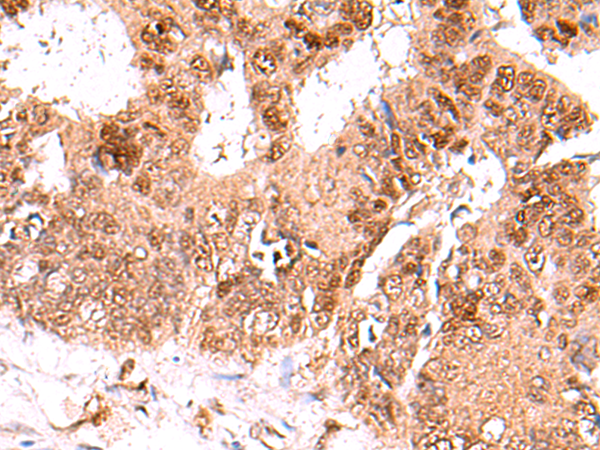 Rabbit Polyclonal Antibody to FDPS