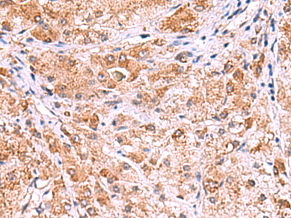 Rabbit Polyclonal Antibody to UXS1