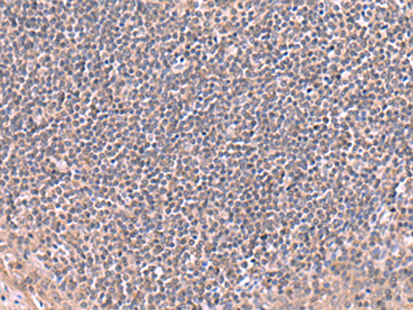 Rabbit Polyclonal Antibody to RIC8A