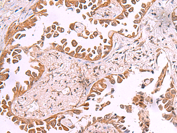 Rabbit Polyclonal Antibody to AK9