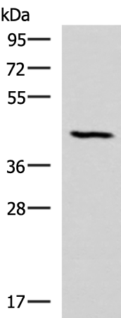 Rabbit Polyclonal Antibody to SMPD2