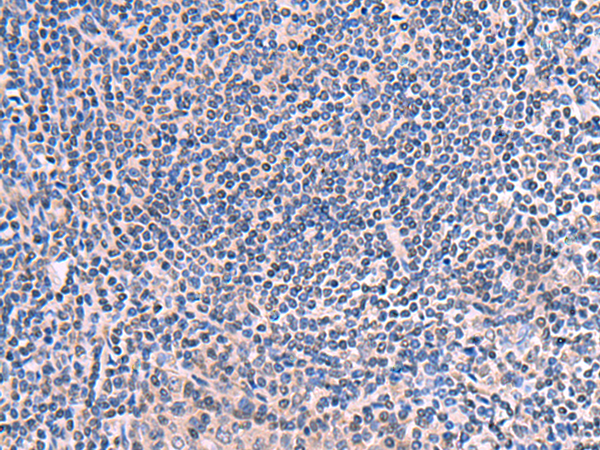 Rabbit Polyclonal Antibody to SCCPDH