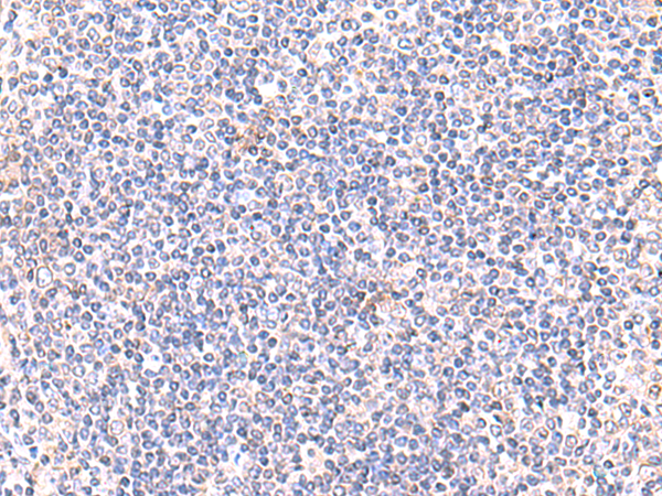 Rabbit Polyclonal Antibody to IFT57