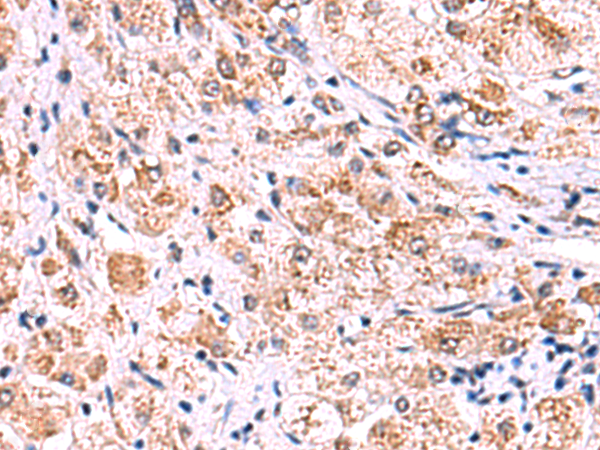Rabbit Polyclonal Antibody to ECSIT