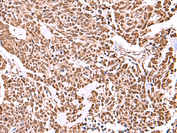 Rabbit Polyclonal Antibody to RCOR3