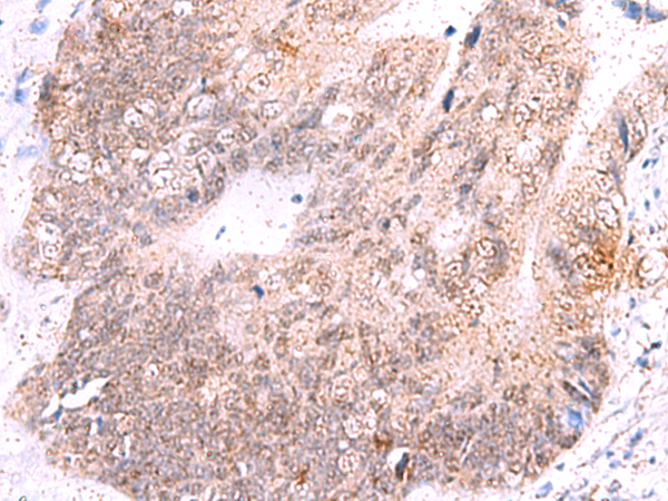 Rabbit Polyclonal Antibody to ASTN2