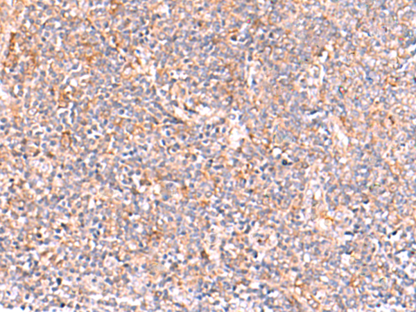 Rabbit Polyclonal Antibody to NADK