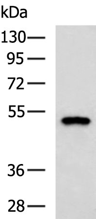 Rabbit Polyclonal Antibody to INPP5K