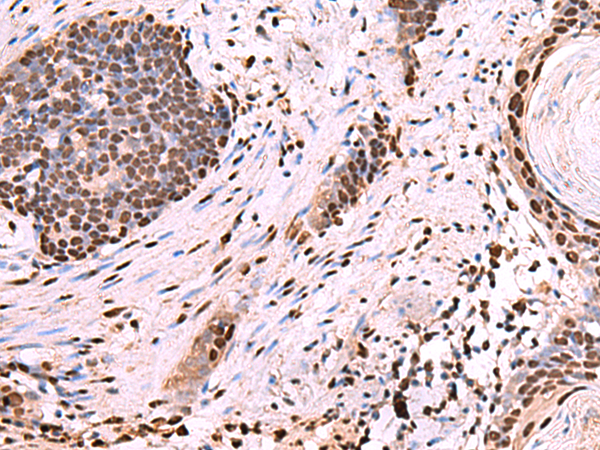 Rabbit Polyclonal Antibody to NASP