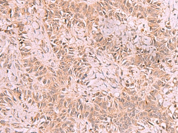 Rabbit Polyclonal Antibody to RRP8
