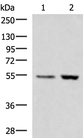 Rabbit Polyclonal Antibody to ZSWIM1