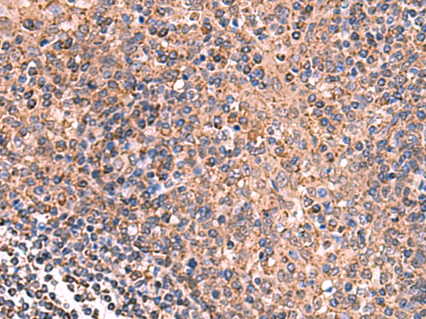 Rabbit Polyclonal Antibody to GALK2