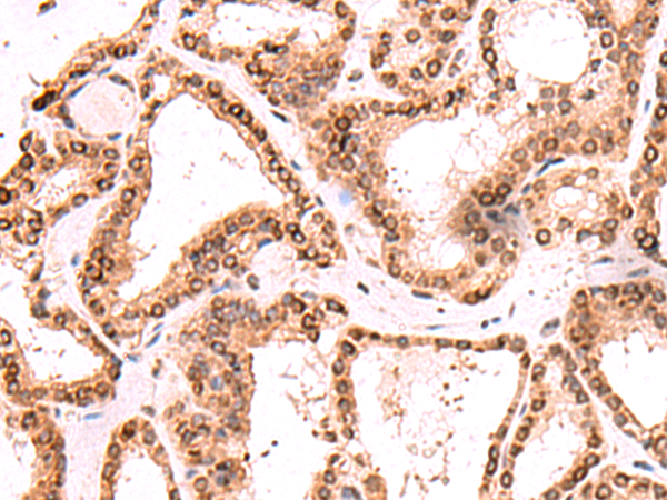Rabbit Polyclonal Antibody to TOR1AIP1