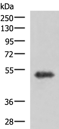 Rabbit Polyclonal Antibody to TSEN2