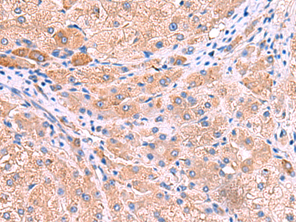 Rabbit Polyclonal Antibody to MPP1