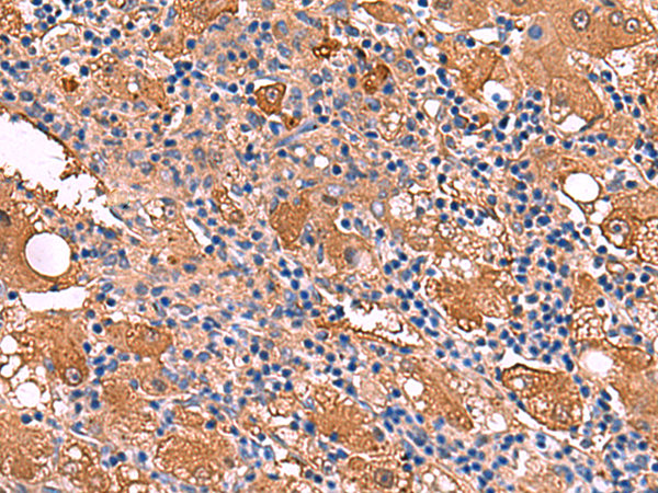 Rabbit Polyclonal Antibody to FUCA2