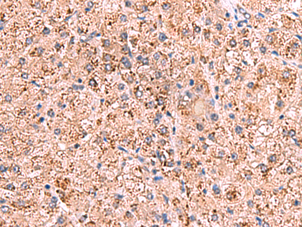 Rabbit Polyclonal Antibody to OSBPL2