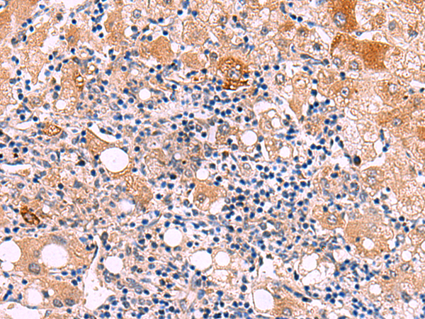 Rabbit Polyclonal Antibody to KATNAL1
