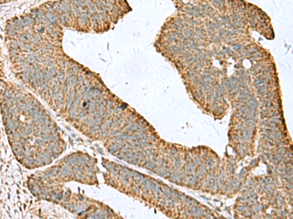 Rabbit Polyclonal Antibody to CDC20