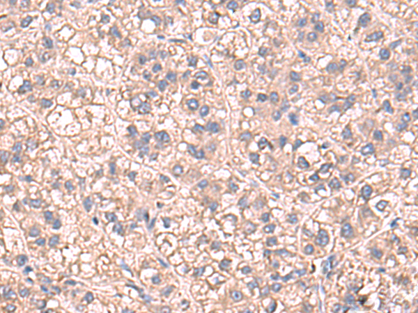 Rabbit Polyclonal Antibody to SARS1