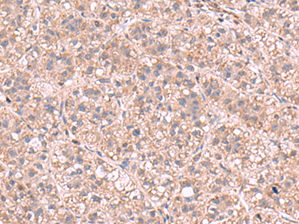 Rabbit Polyclonal Antibody to KPNA2