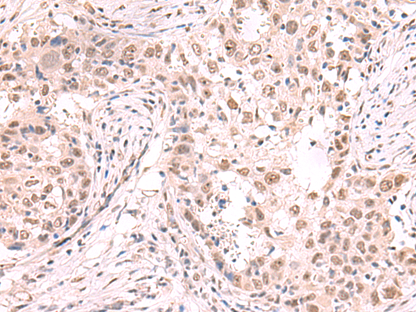Rabbit Polyclonal Antibody to ZNF559