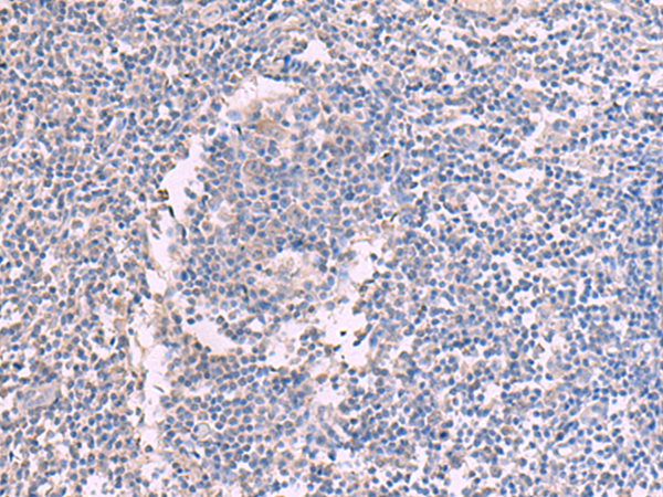 Rabbit Polyclonal Antibody to CCT5