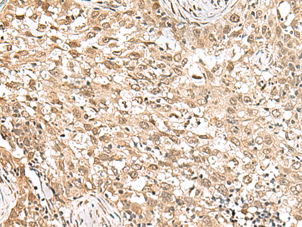 Rabbit Polyclonal Antibody to RPS6KA5