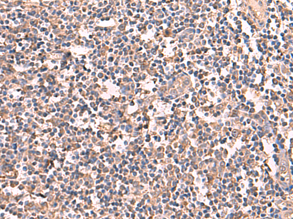 Rabbit Polyclonal Antibody to RIOK1