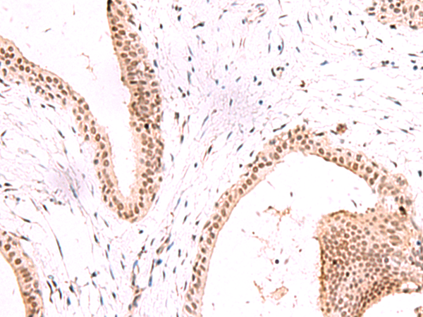 Rabbit Polyclonal Antibody to CBFA2T2