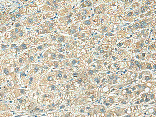Rabbit Polyclonal Antibody to KLC2