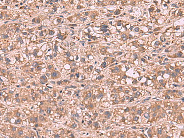 Rabbit Polyclonal Antibody to SHC4