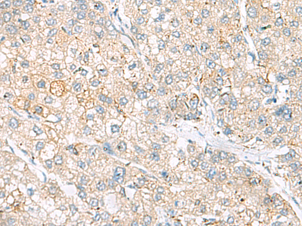 Rabbit Polyclonal Antibody to FARP2
