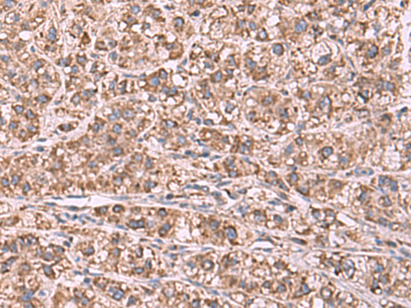 Rabbit Polyclonal Antibody to GUSB