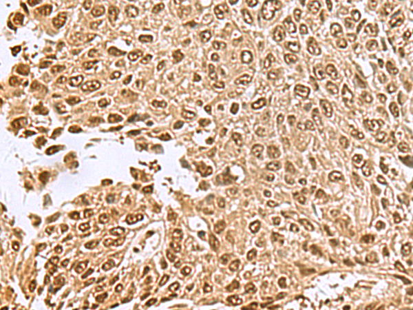 Rabbit Polyclonal Antibody to NVL
