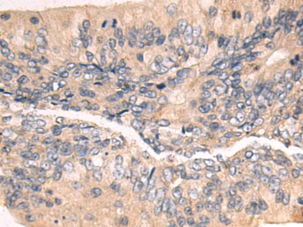 Rabbit Polyclonal Antibody to PPP2R1B
