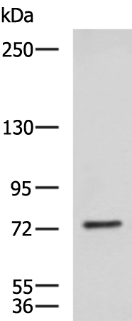 Rabbit Polyclonal Antibody to KIF2A