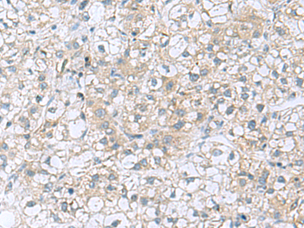 Rabbit Polyclonal Antibody to TRO
