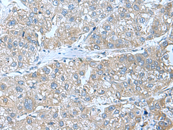 Rabbit Polyclonal Antibody to SRPK2