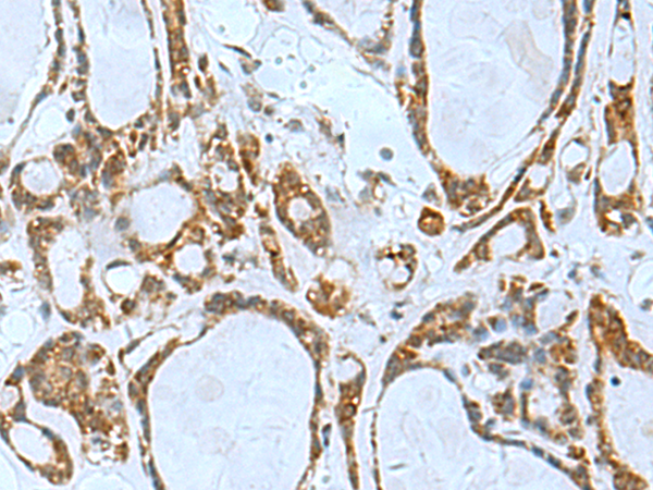 Rabbit Polyclonal Antibody to TSGA10