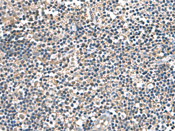 Rabbit Polyclonal Antibody to IP6K2
