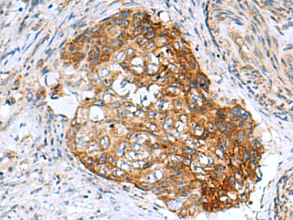 Rabbit Polyclonal Antibody to AP1S3