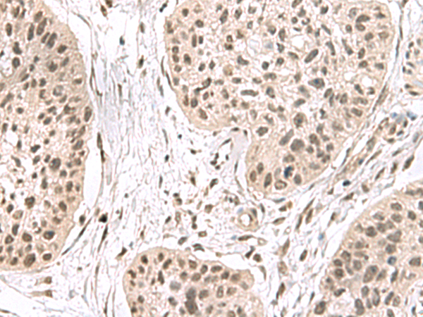 Rabbit Polyclonal Antibody to ERH