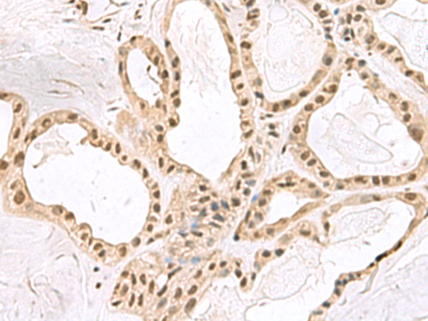 Rabbit Polyclonal Antibody to PCLAF