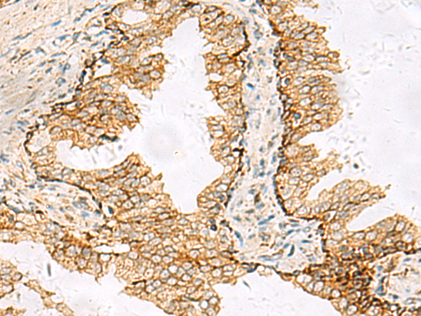 Rabbit Polyclonal Antibody to SH3YL1